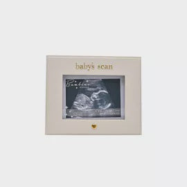 Photo Frame: Resin Baby Scan - White -  Bambino